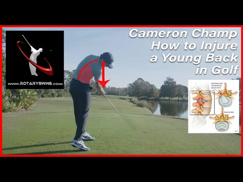 Cameron Champ Back Injury – The Beginning of the End of His Career
