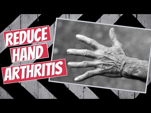 7 Tips to Reduce Hand Arthritis Pain (Physical Therapy Approved)
