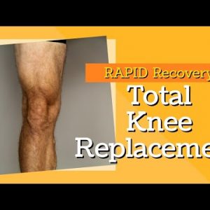 2 Key Exercises to Rapid Recovery for Total Knee Replacement